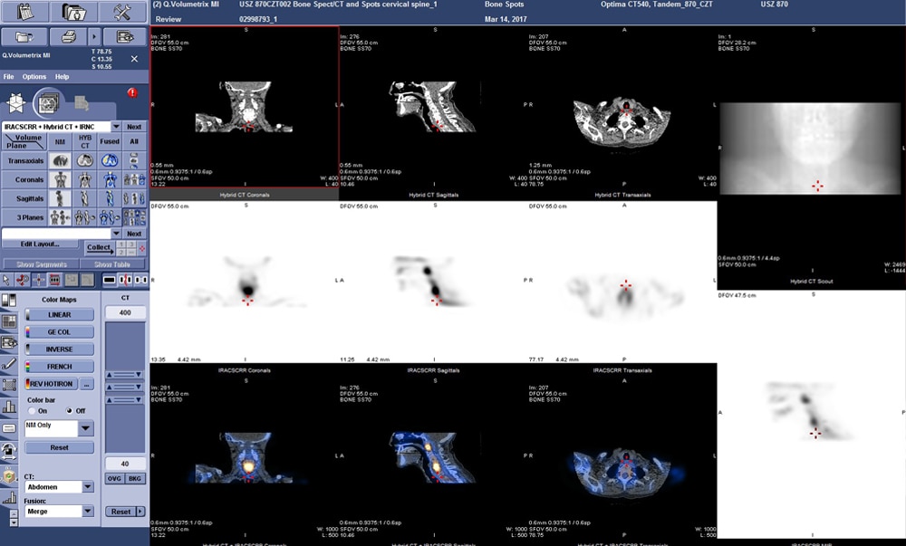 NM/CT 870 CZT | GE Healthcare