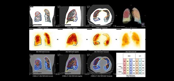 NM/CT 860 | GE Healthcare