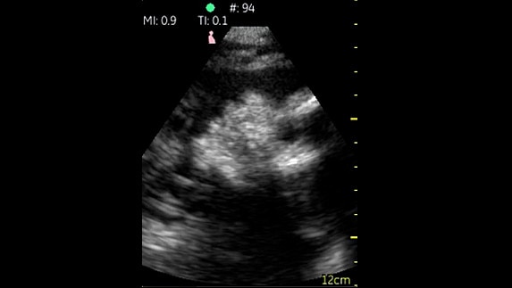 hotspot tours-vscan-fetal-profile_jpg