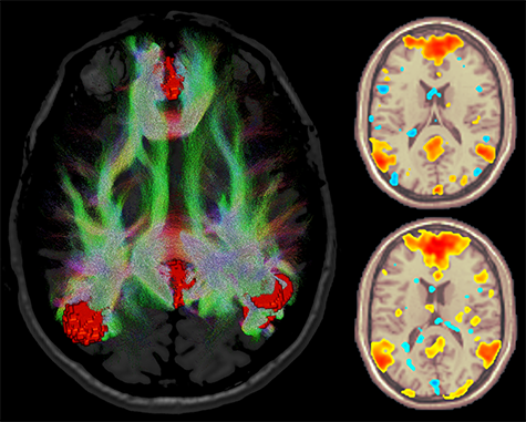 product-product-categories-magnetic-resonance-imaging-signa premier-fmri.png