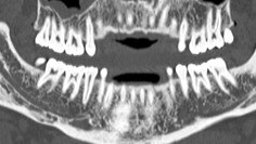 visualização avançada dentascan plus.