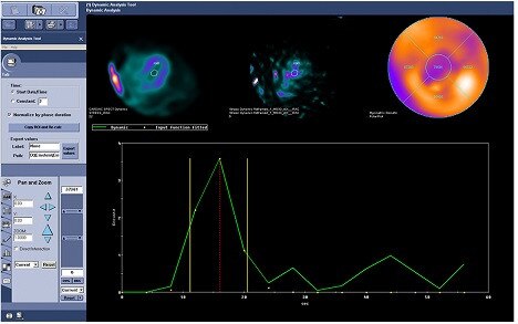 Images-Product-Product-Categories-Nuclear-Medicine-Cardiac-imaging-alcyone-dynamic.jpg