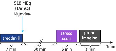 ine-cardiac scanners-discovery nm 530c-discovery-nm-530c-case-study_prone_stress_graph.jpg