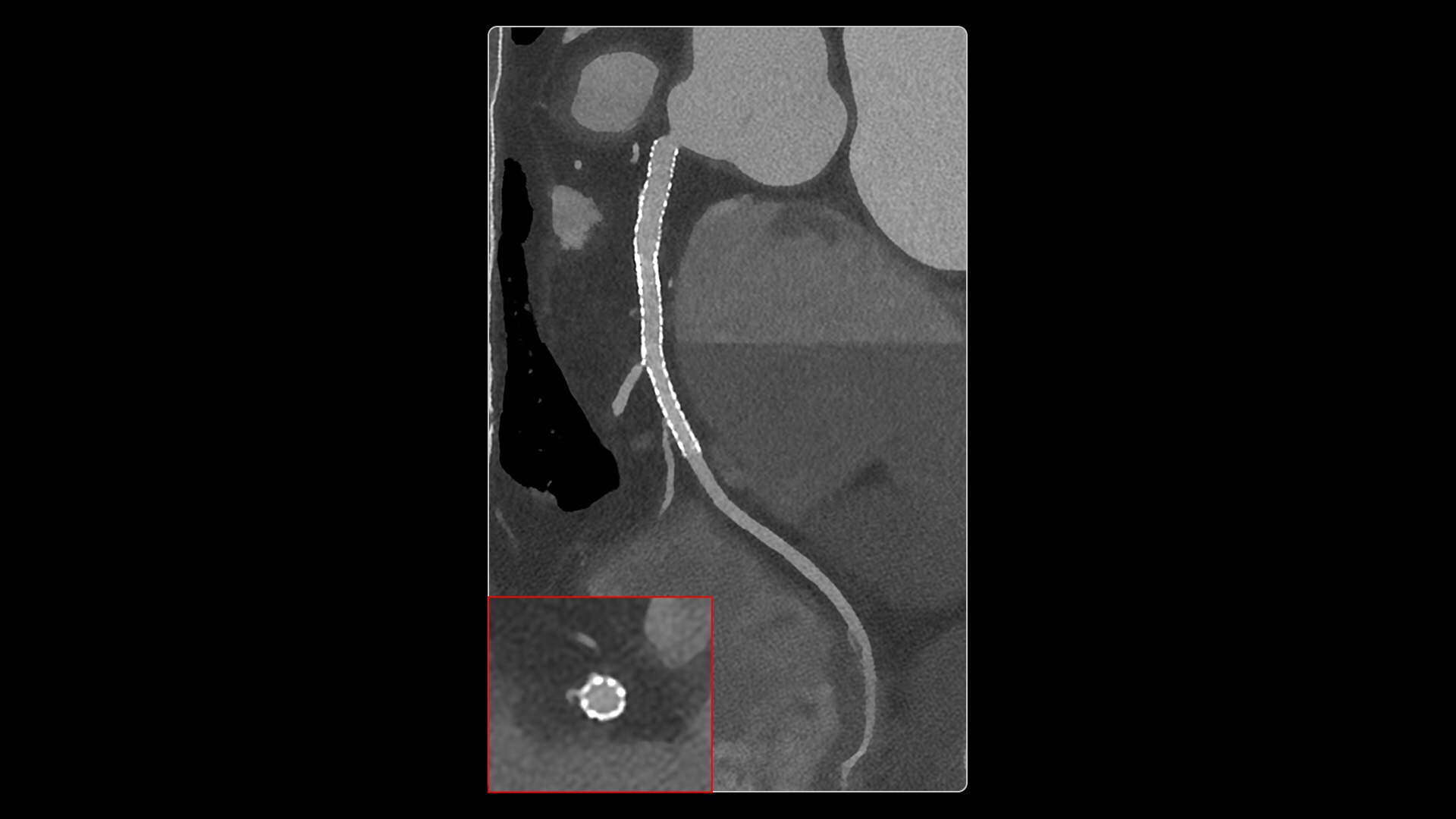 Product Media Carousel Image