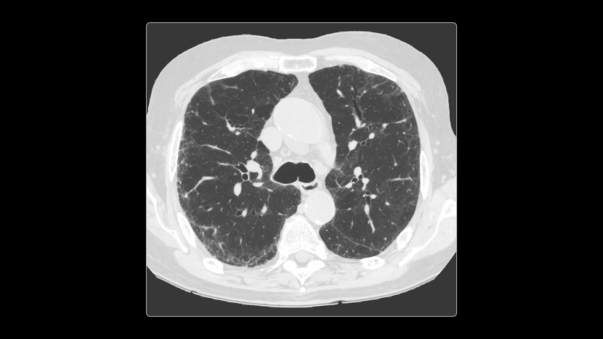 Product Media Carousel Image