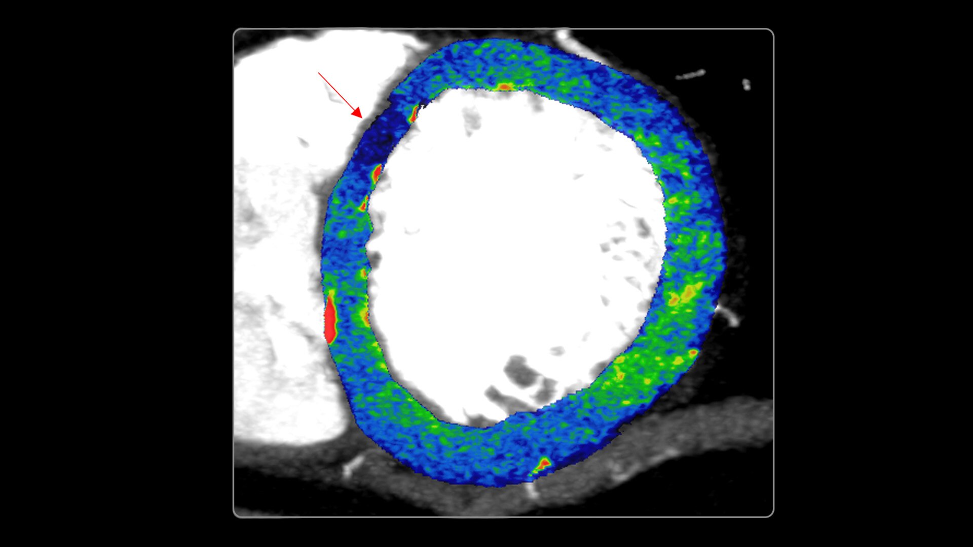 Product Media Carousel Image