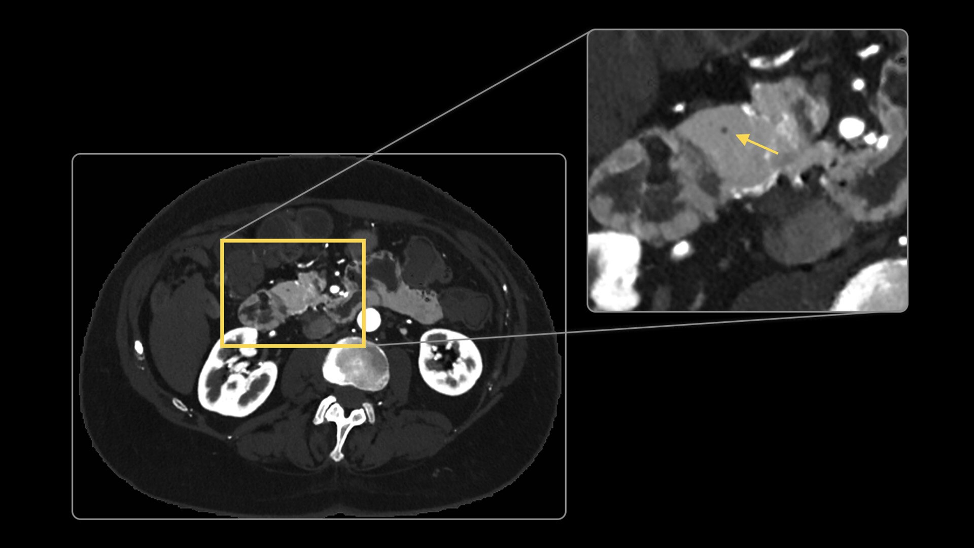 Product Media Carousel Image
