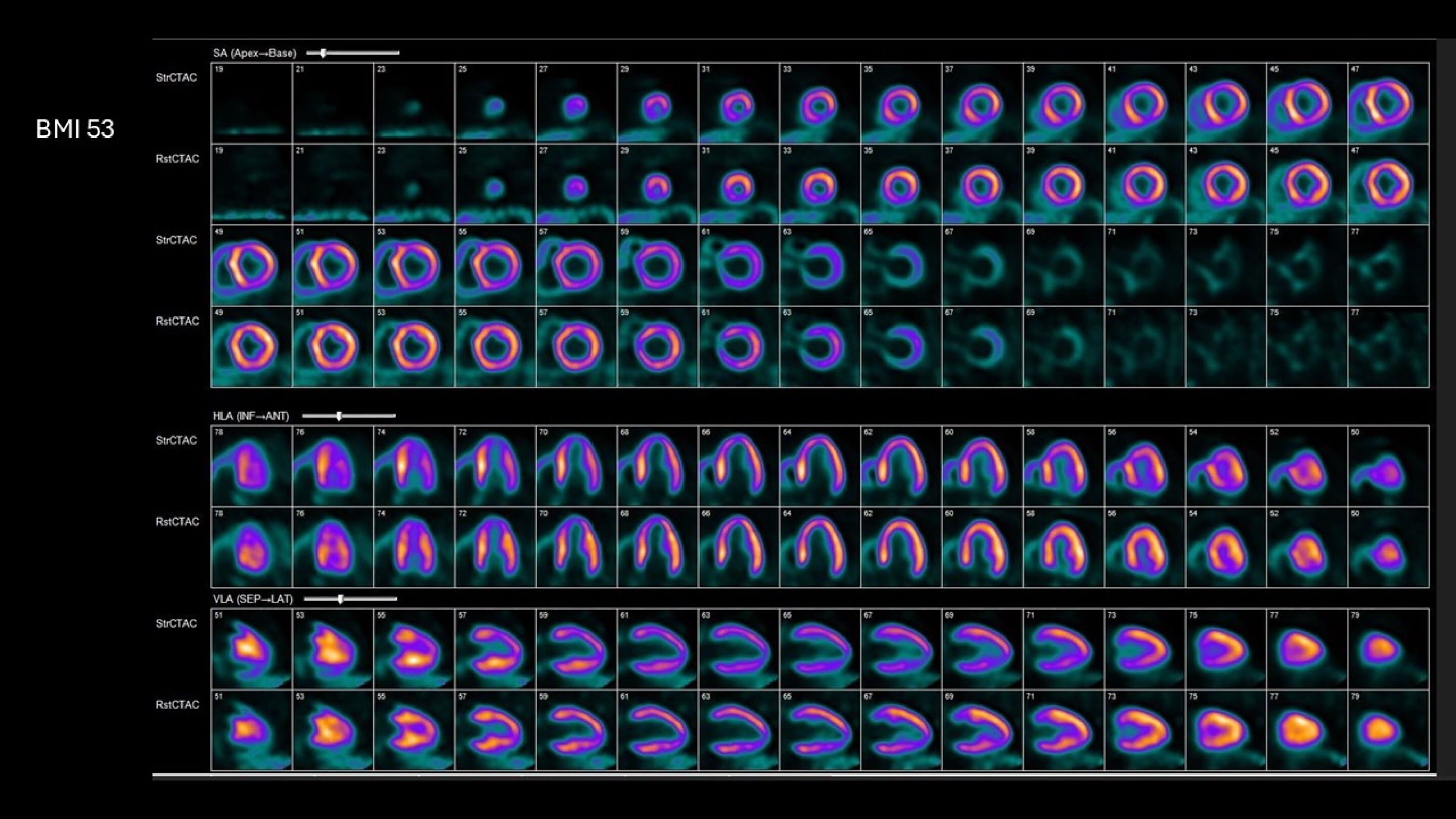 Collection Carousel Image