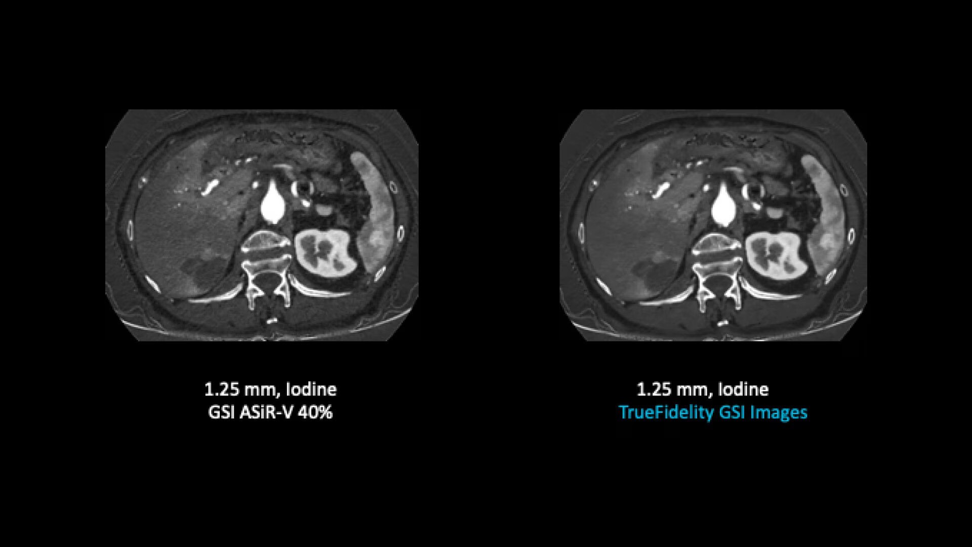 Product Media Carousel Image