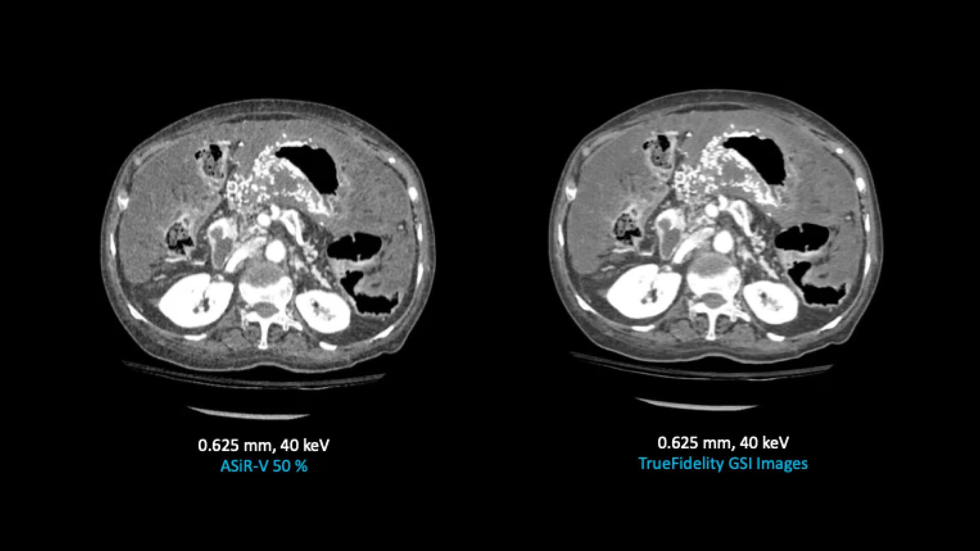 Product Media Carousel Image