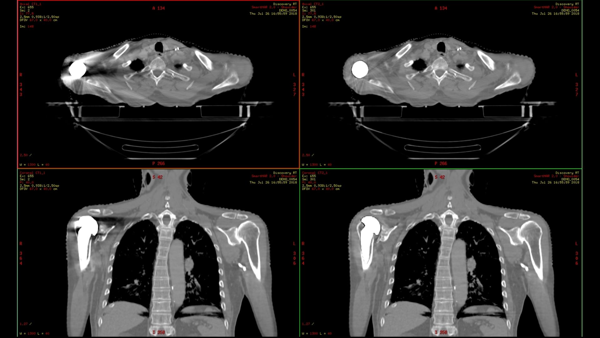 Product Media Carousel Image