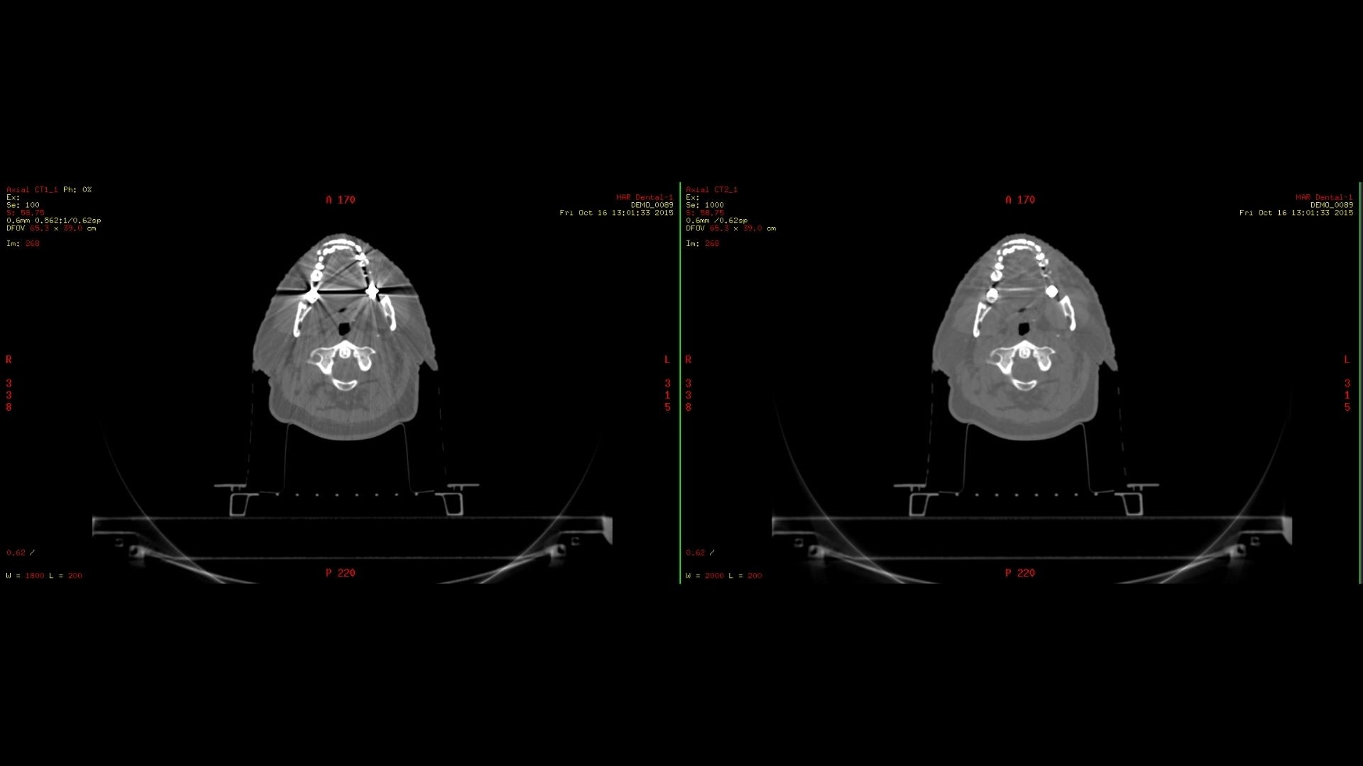 Product Media Carousel Image