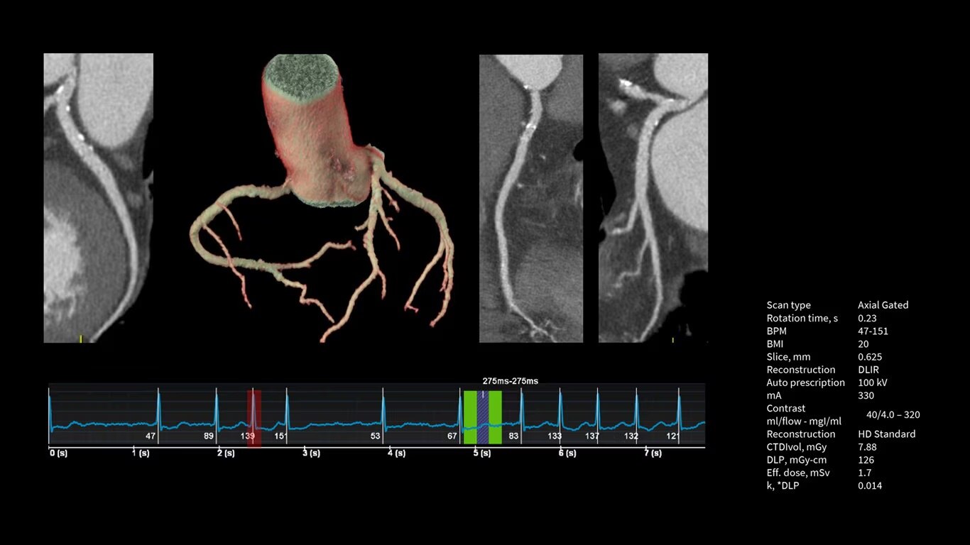Product Media Carousel Image