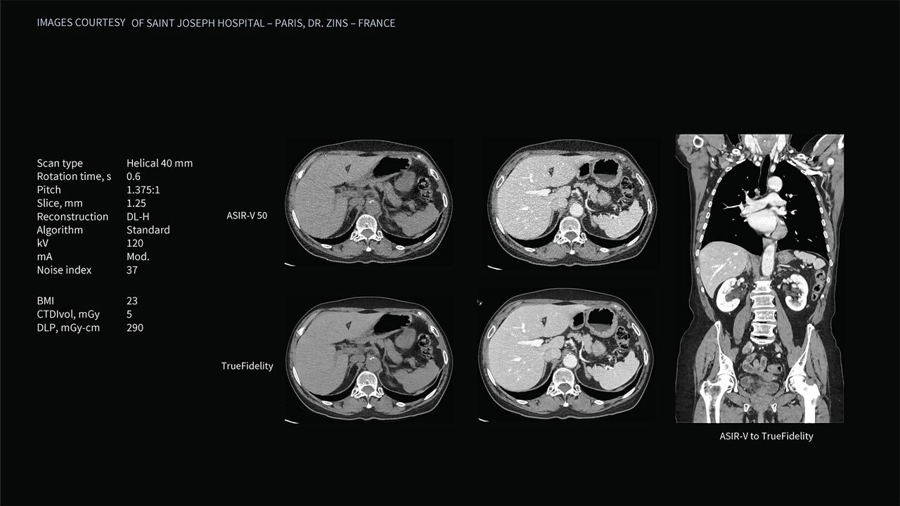 Product Media Carousel Image