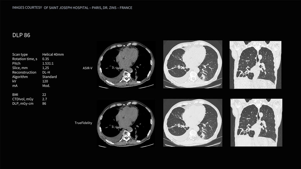 Product Media Carousel Image