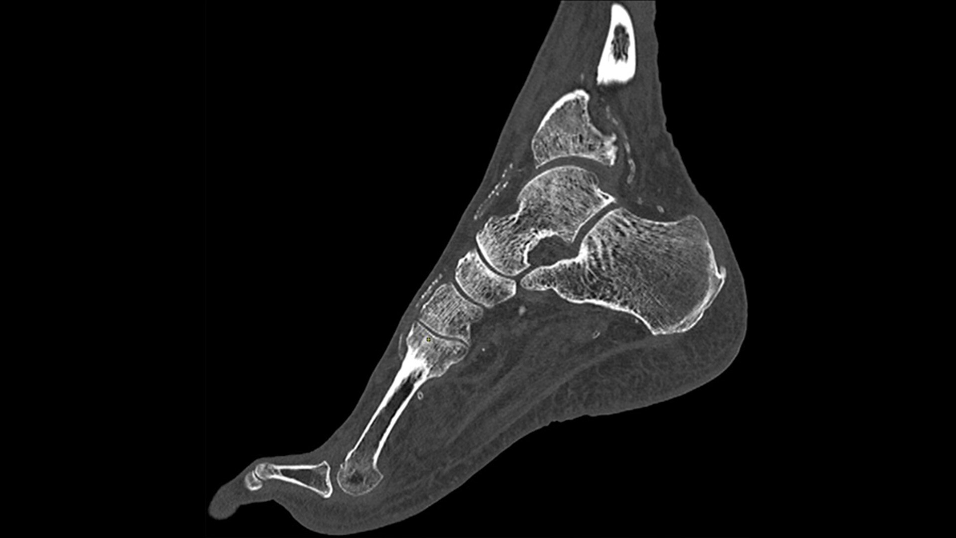 Product Media Carousel Image