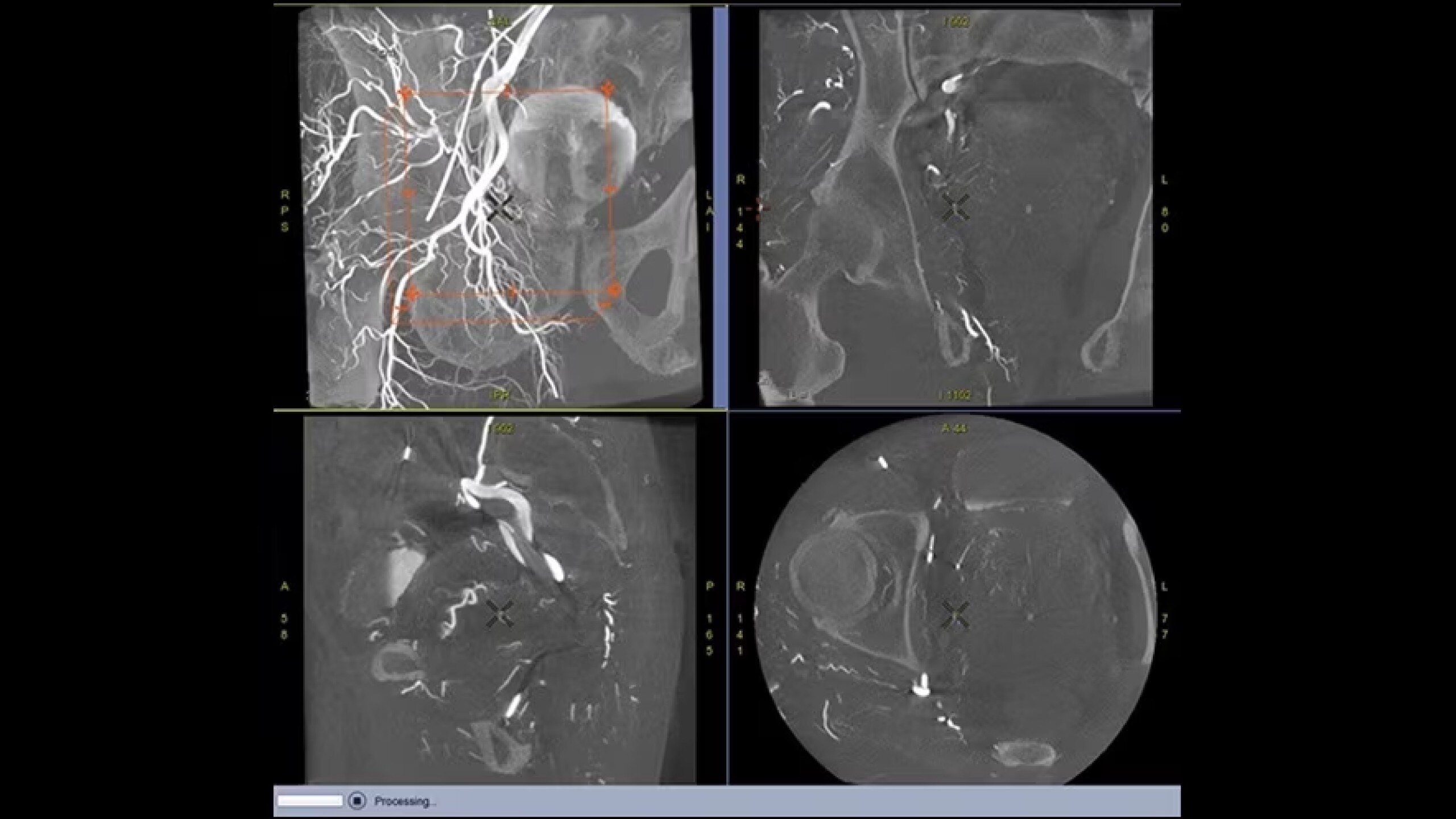 Product Media Carousel Image