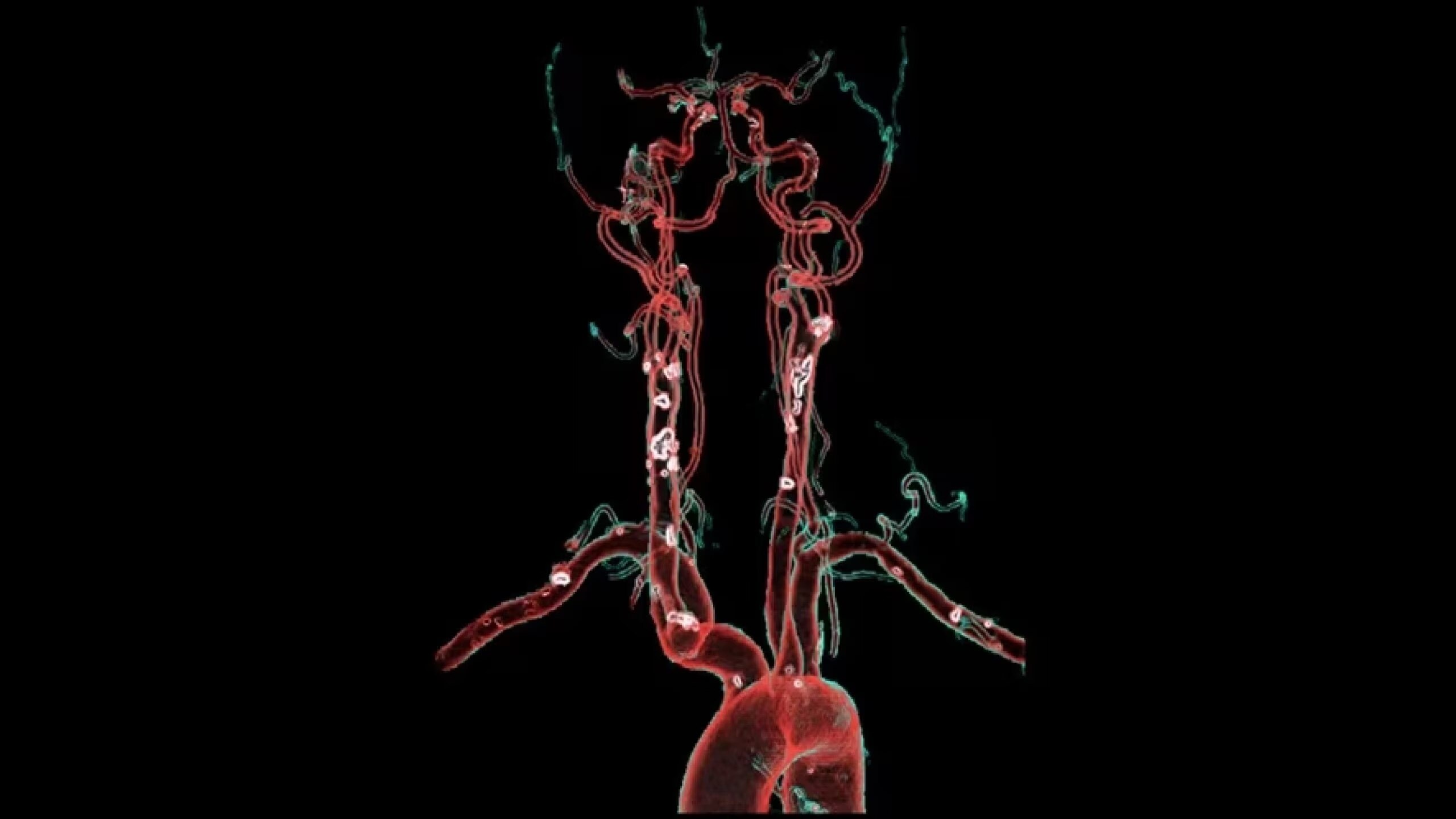 Product Media Carousel Image