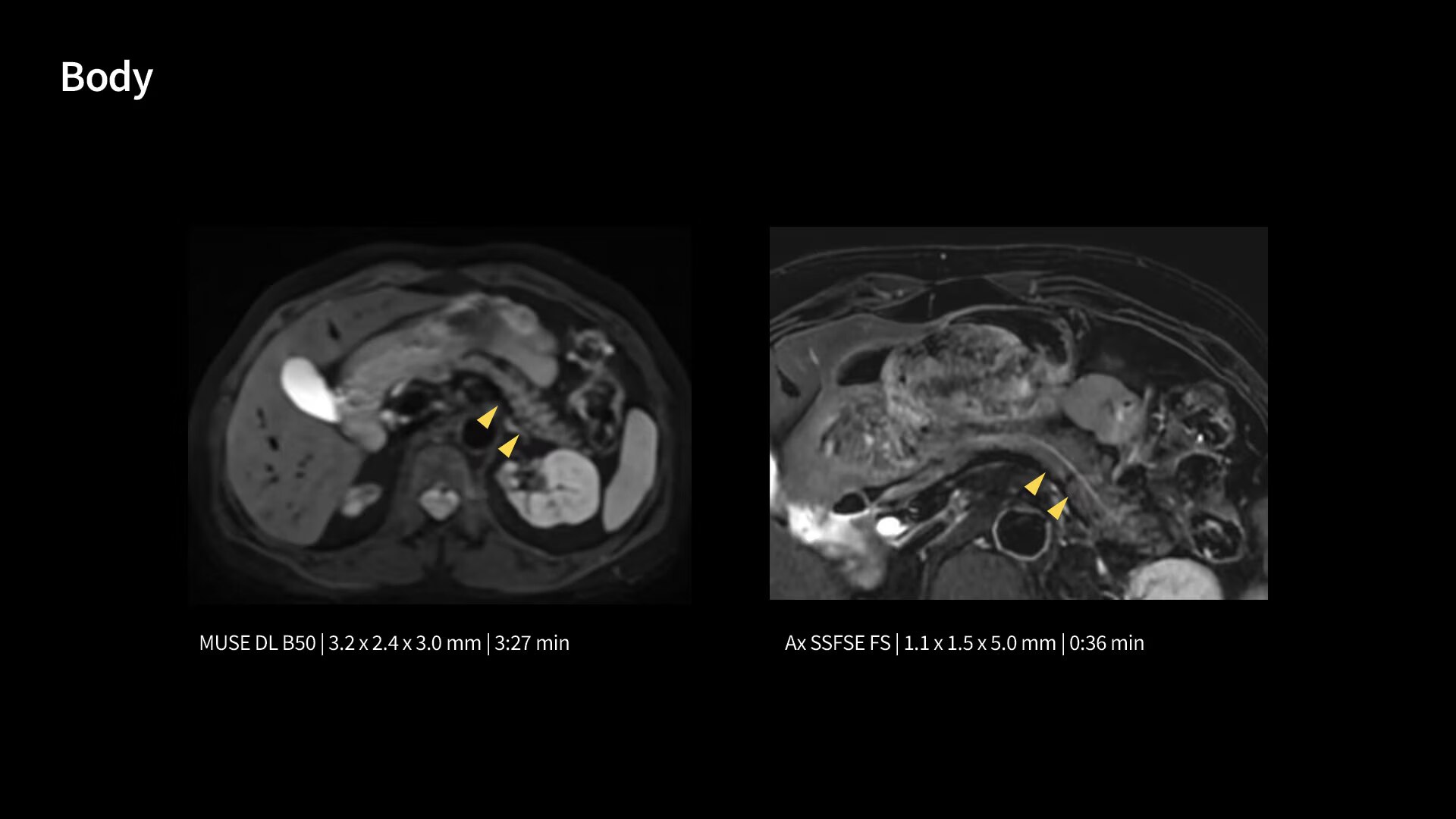 Product Media Carousel Image