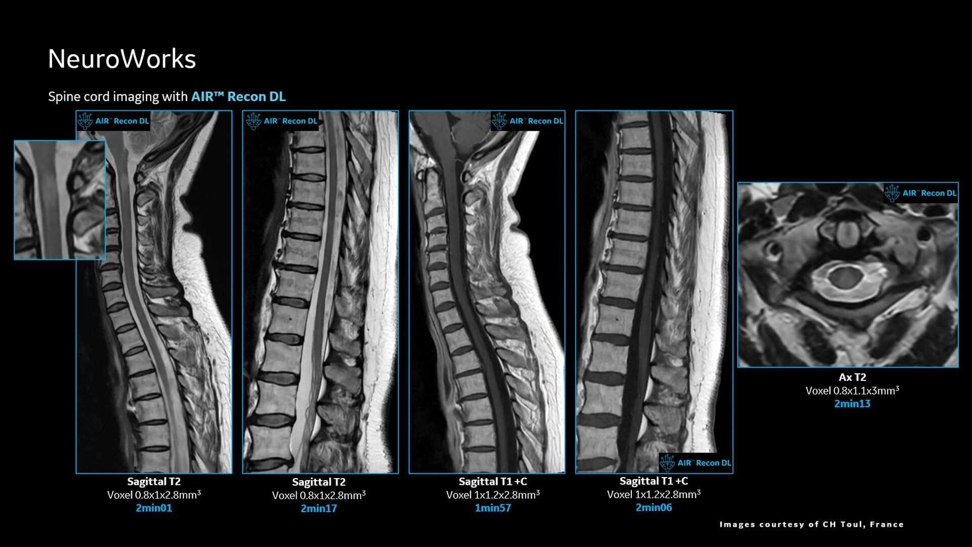 Product Media Carousel Image