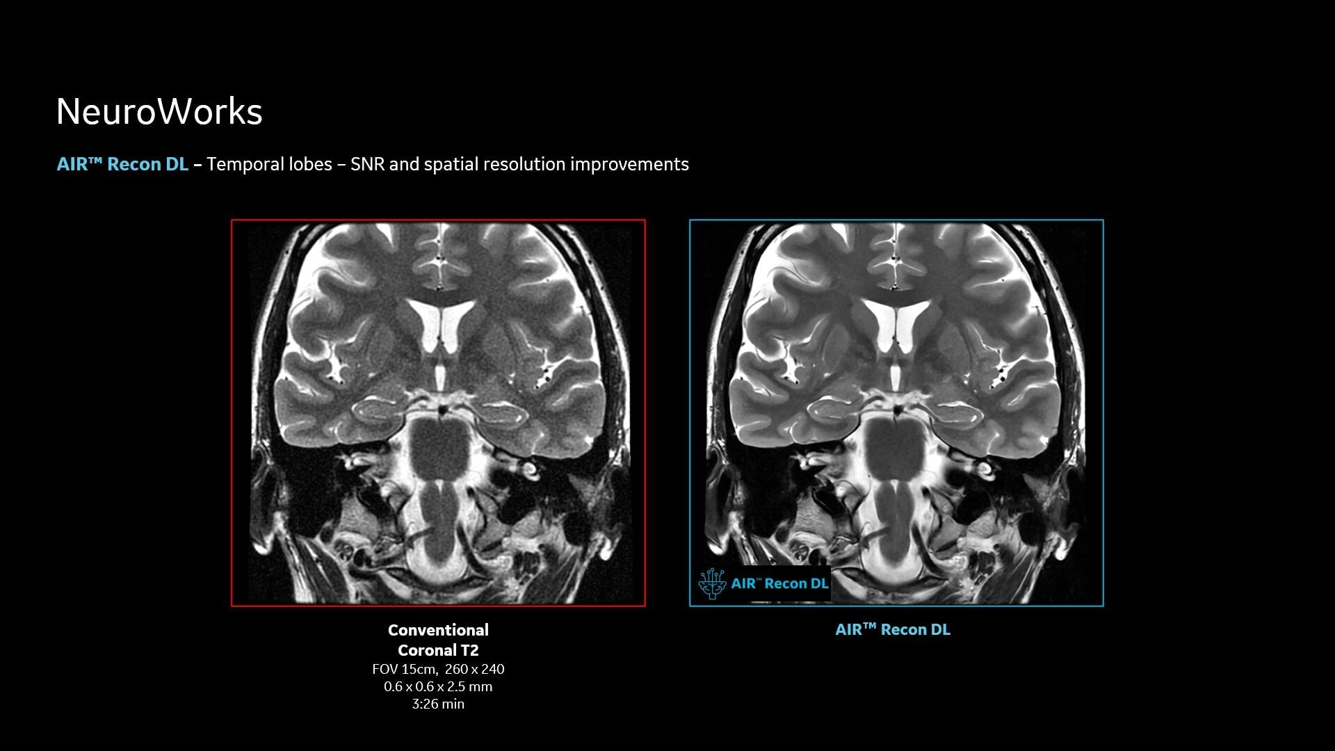Product Media Carousel Image