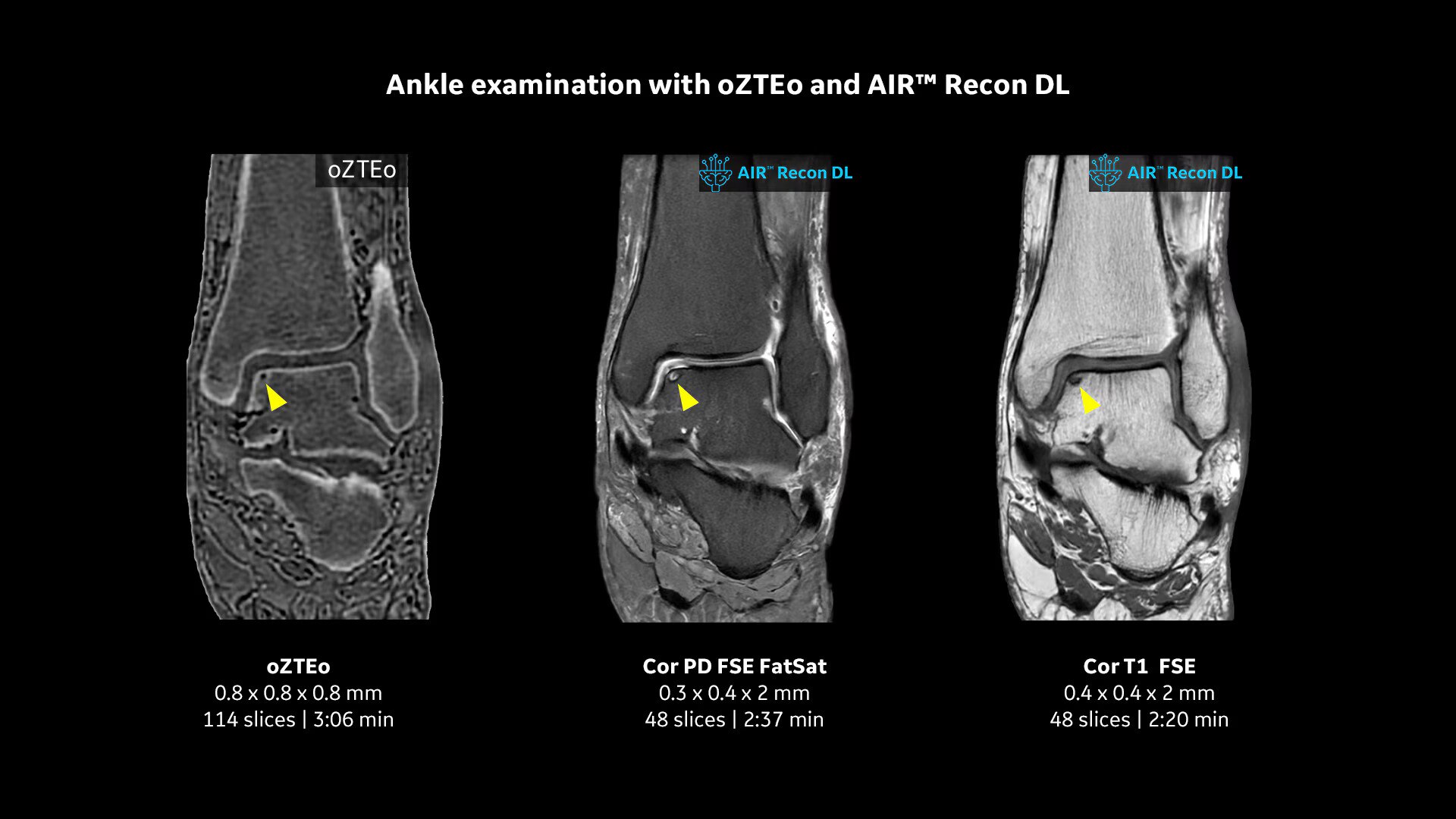 Product Media Carousel Image