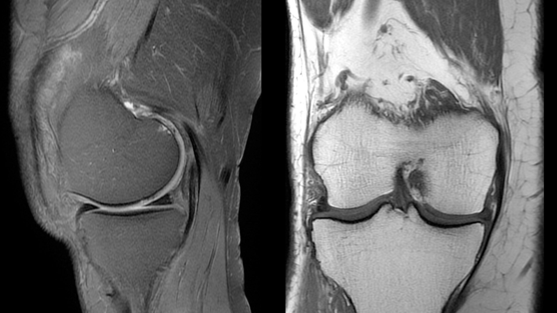 Product Media Carousel Image