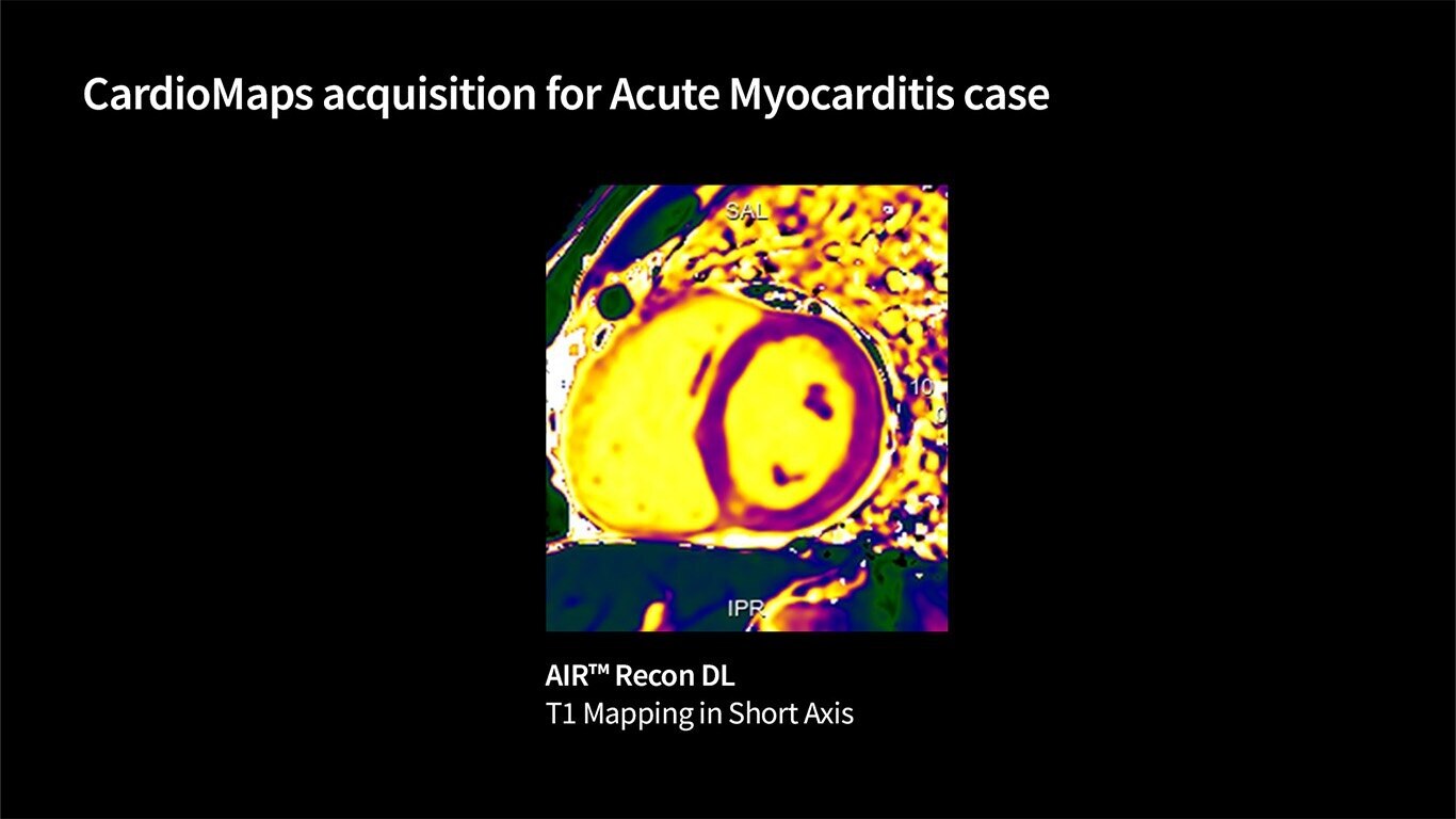 Product Media Carousel Image