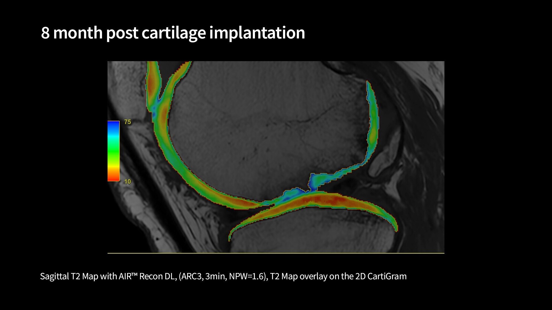 Product Media Carousel Image