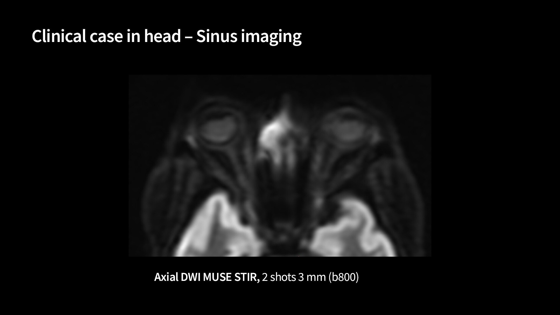 Product Media Carousel Image