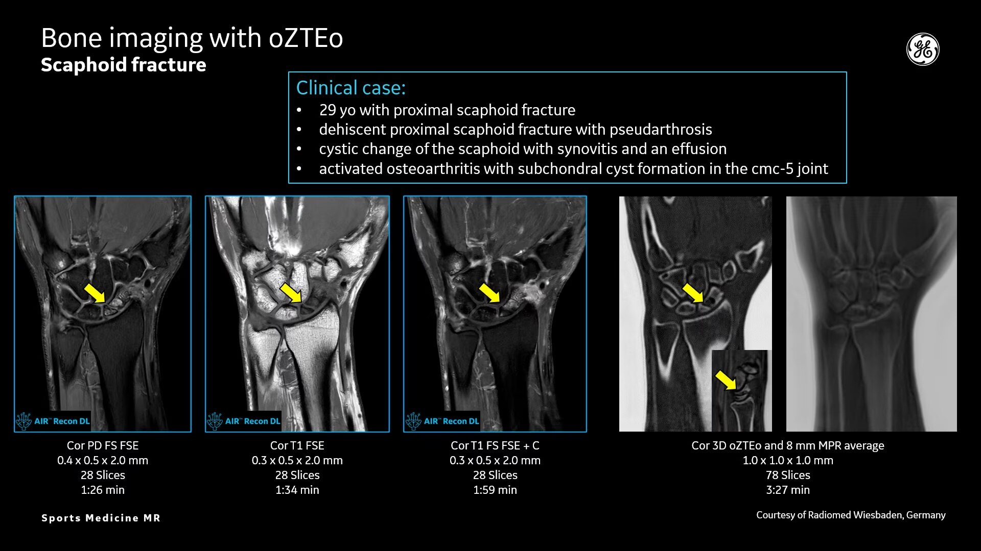 Product Media Carousel Image