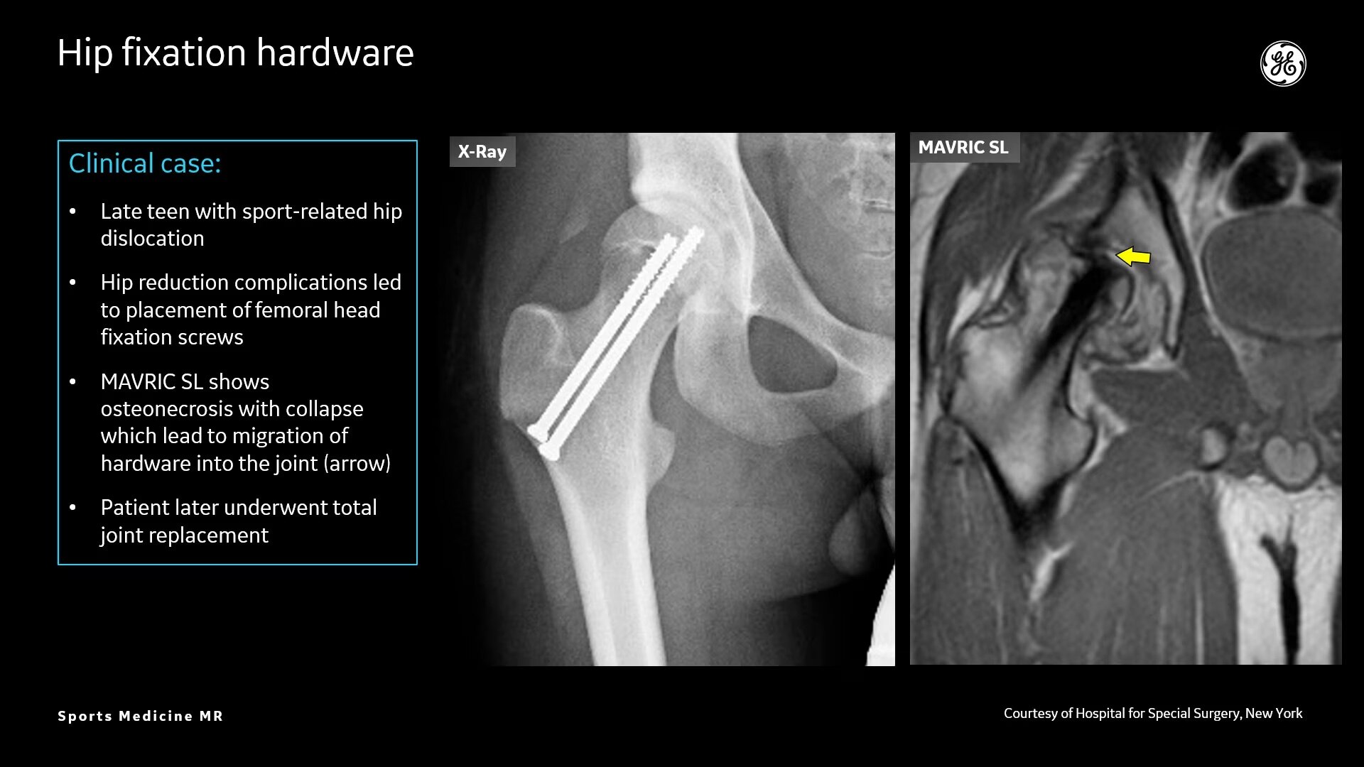 Product Media Carousel Image