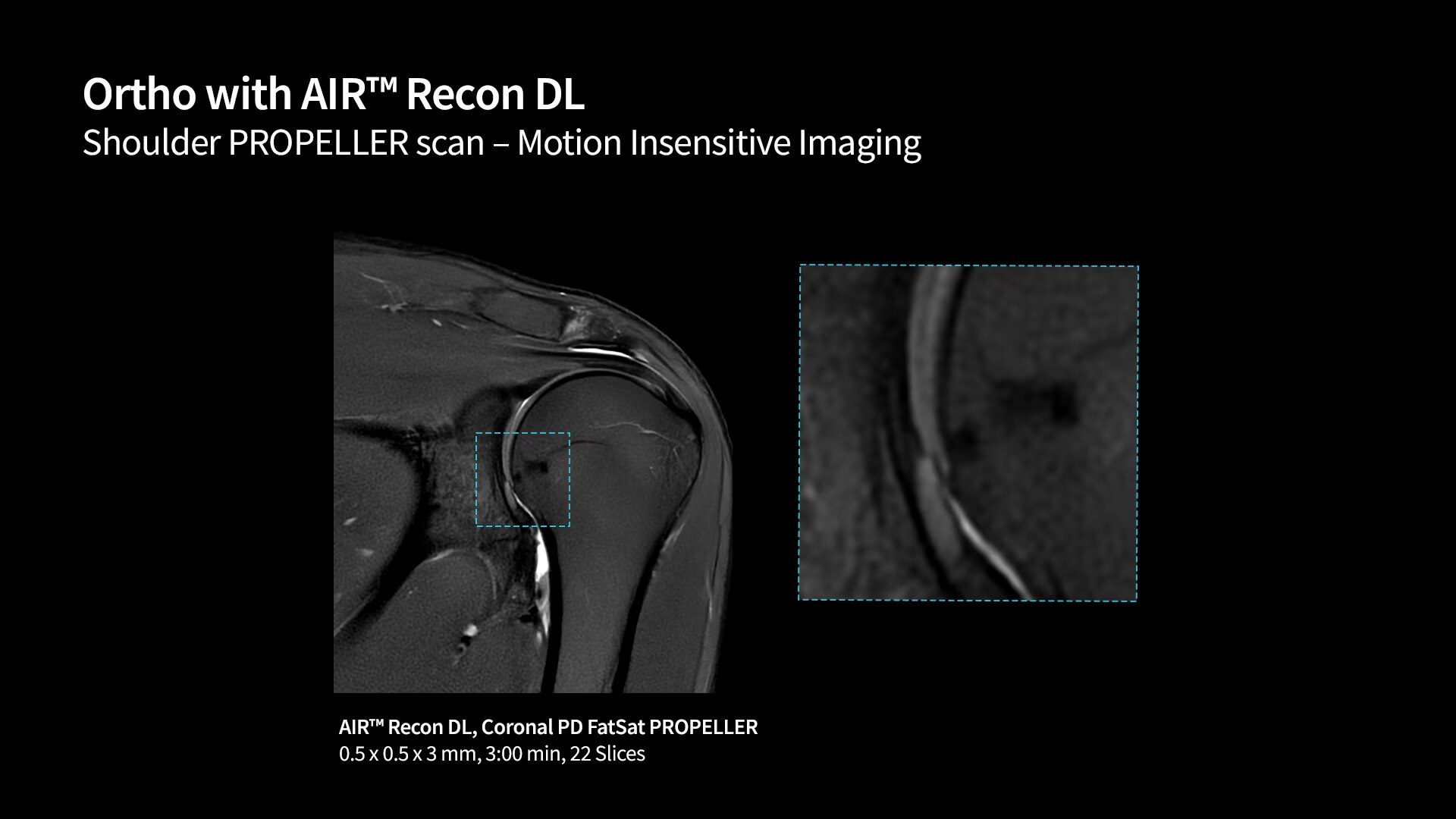 Product Media Carousel Image