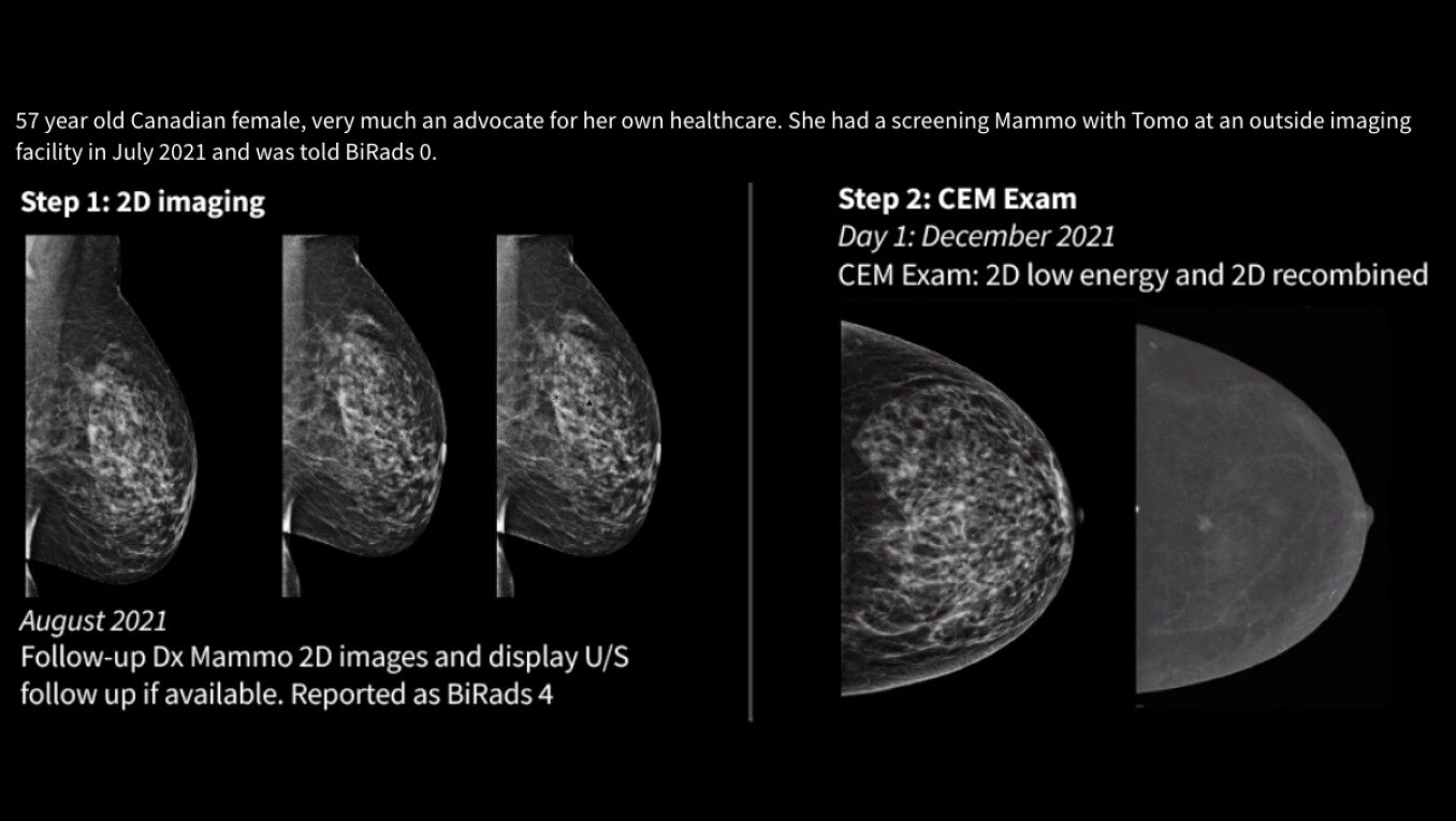 Product Media Carousel Image