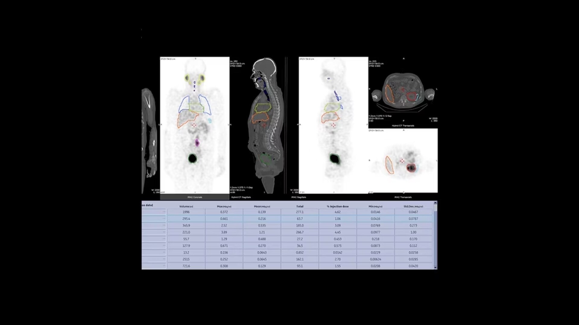 Product Media Carousel Image