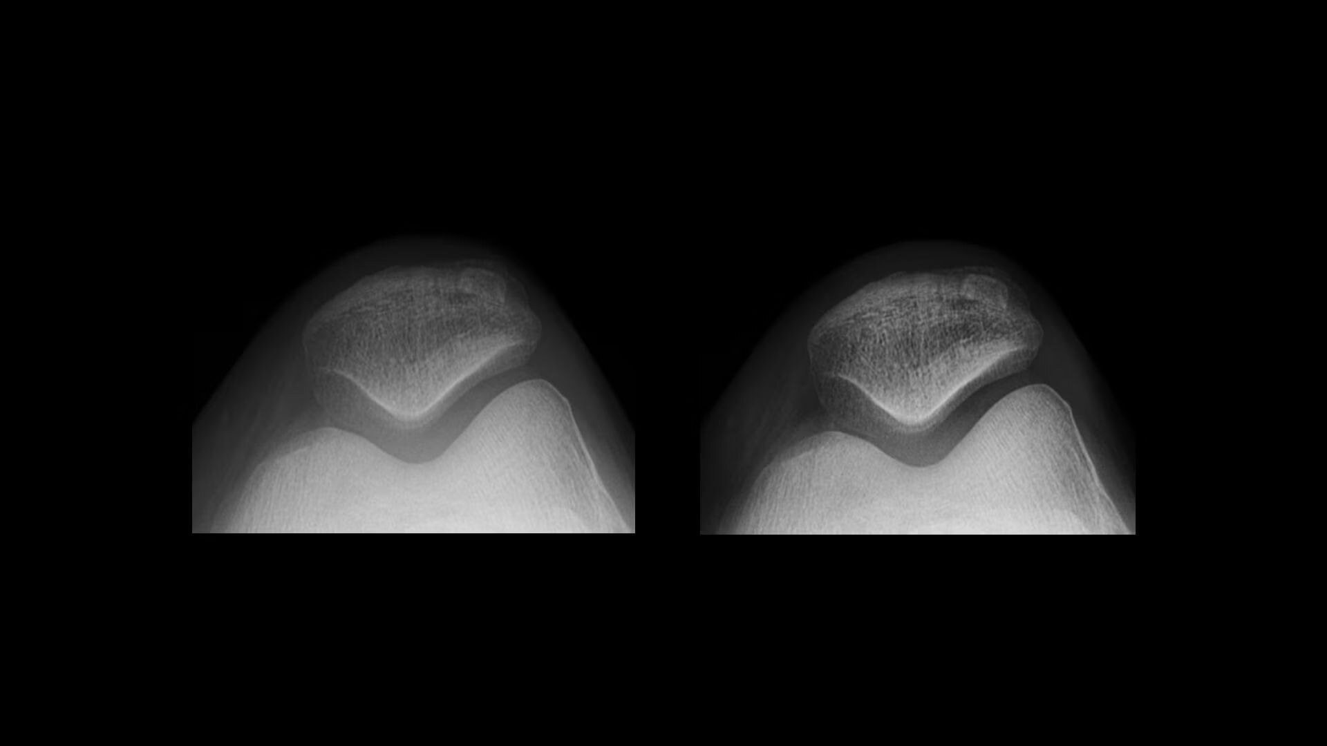 Product Media Carousel Image