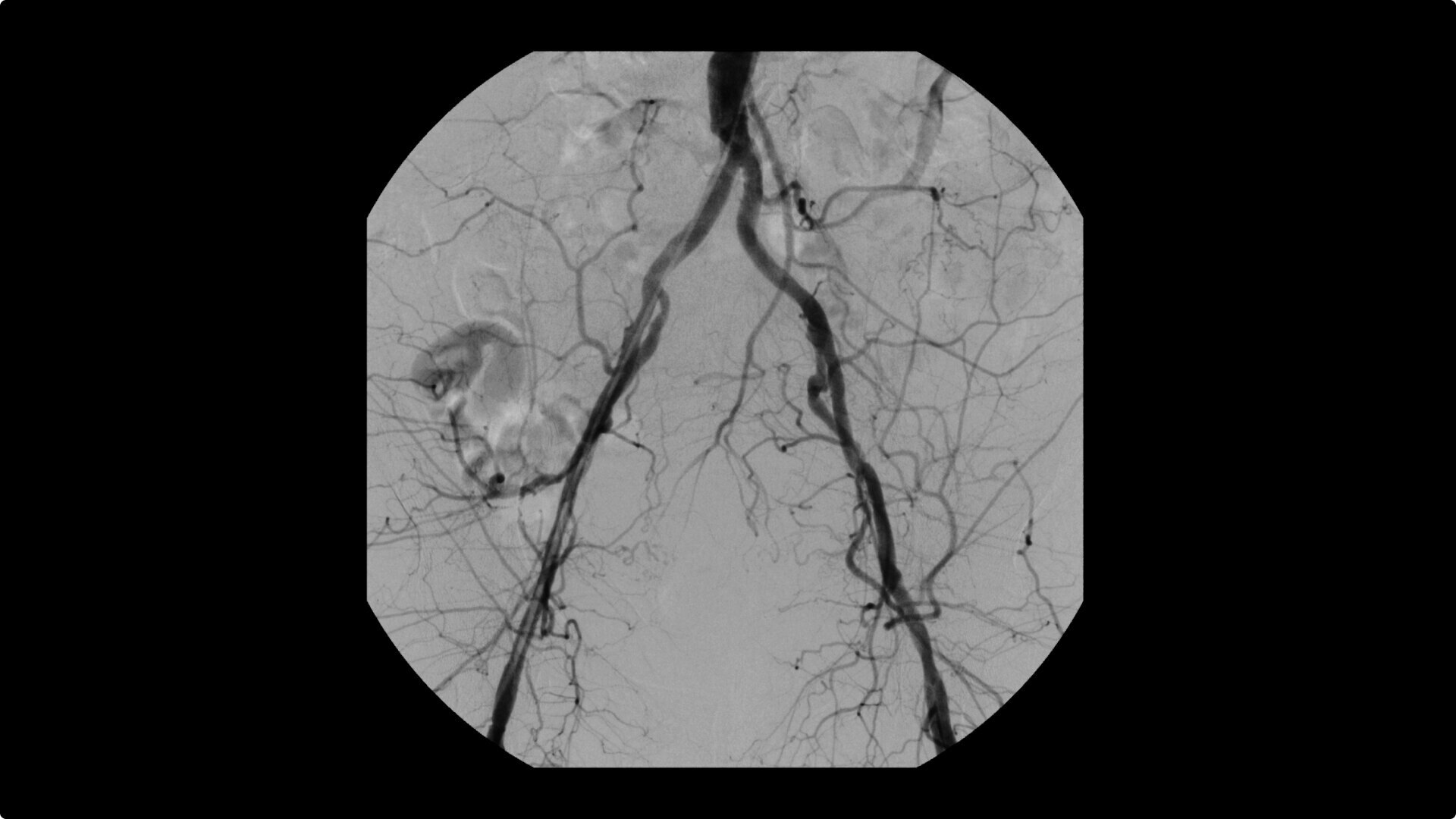 Product Media Carousel Image