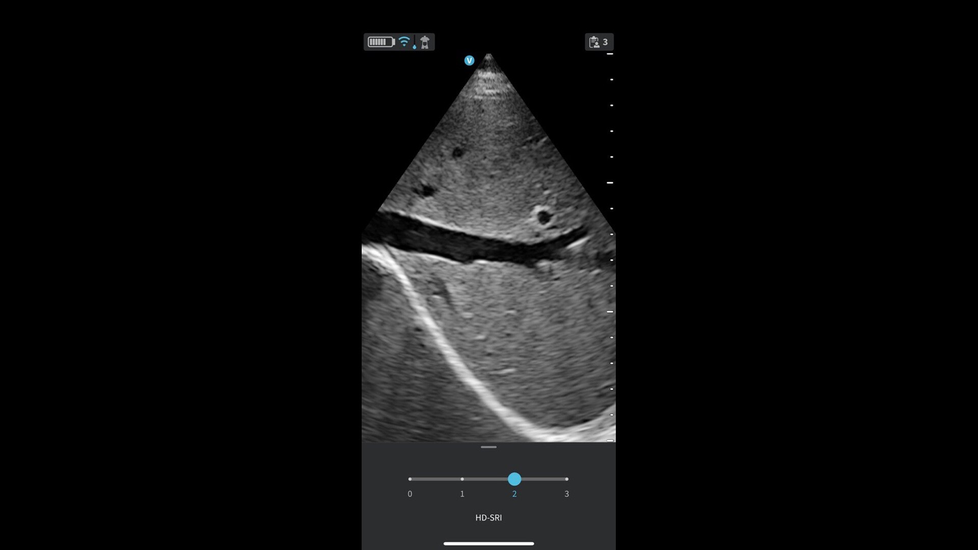 Product Media Carousel Image