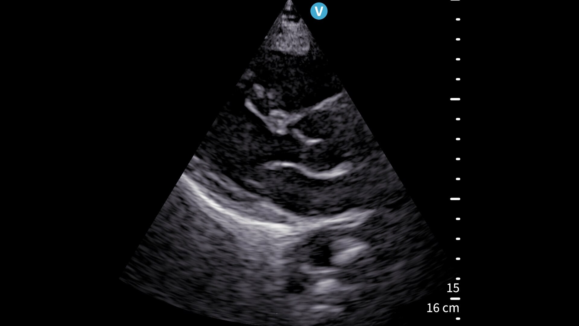 Product Media Carousel Image