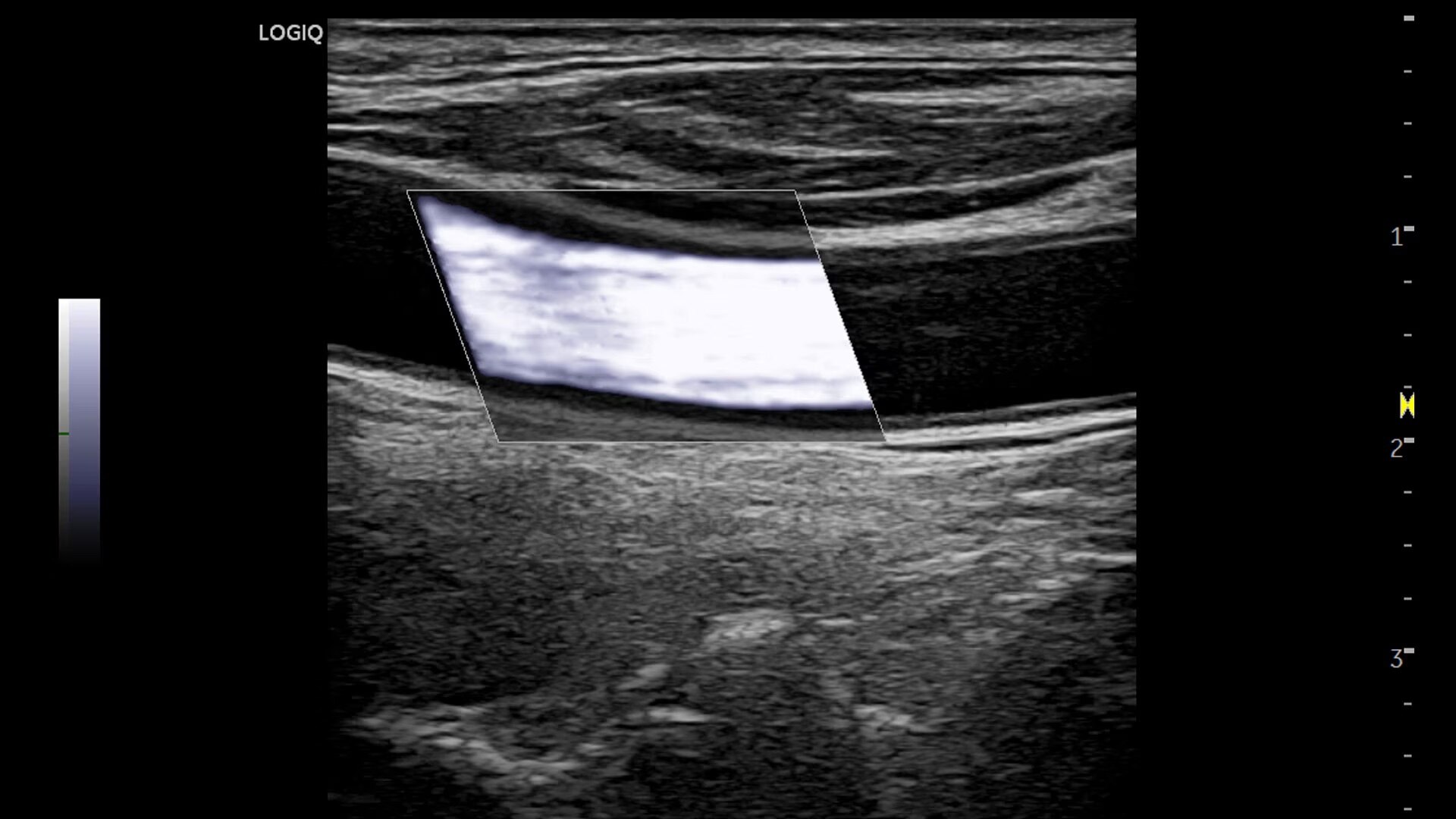 Product Media Carousel Image