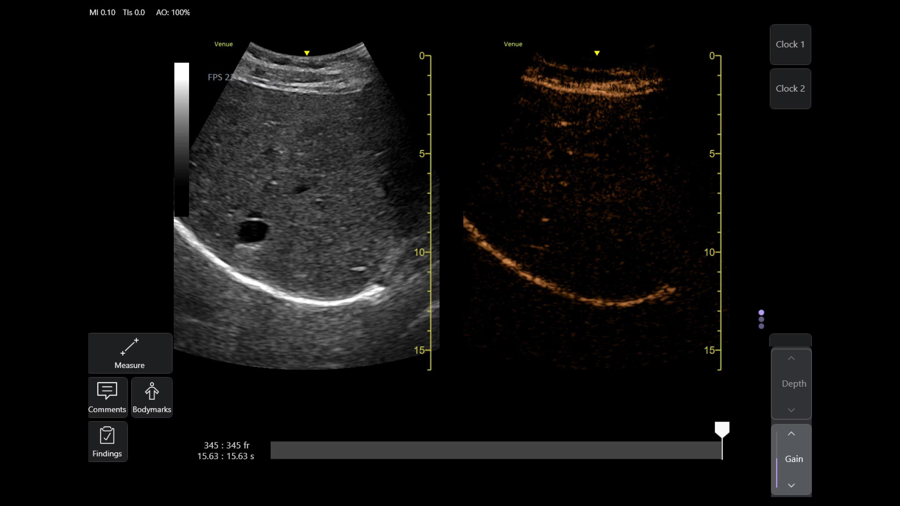 Product Media Carousel Image