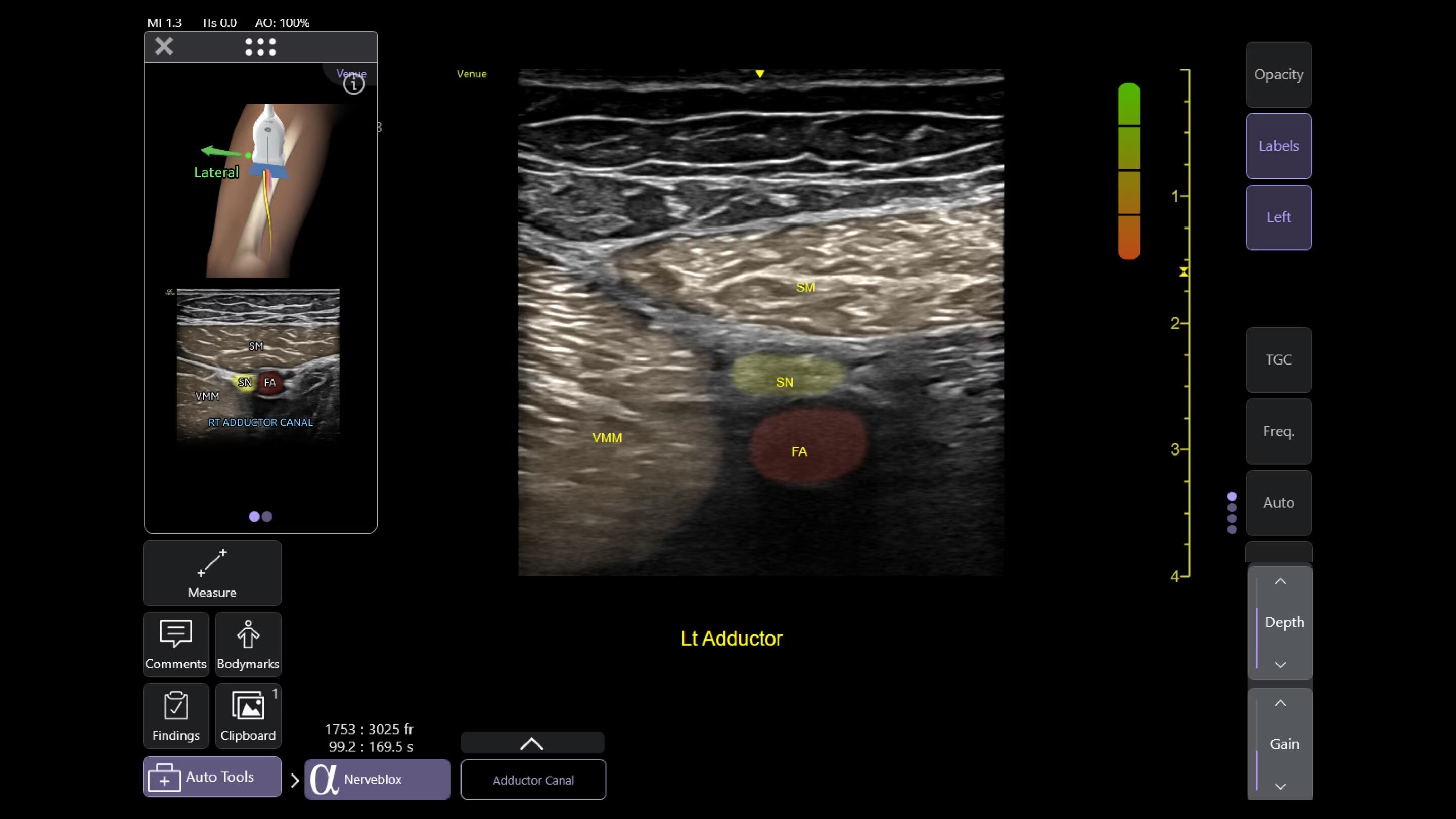 Product Media Carousel Image