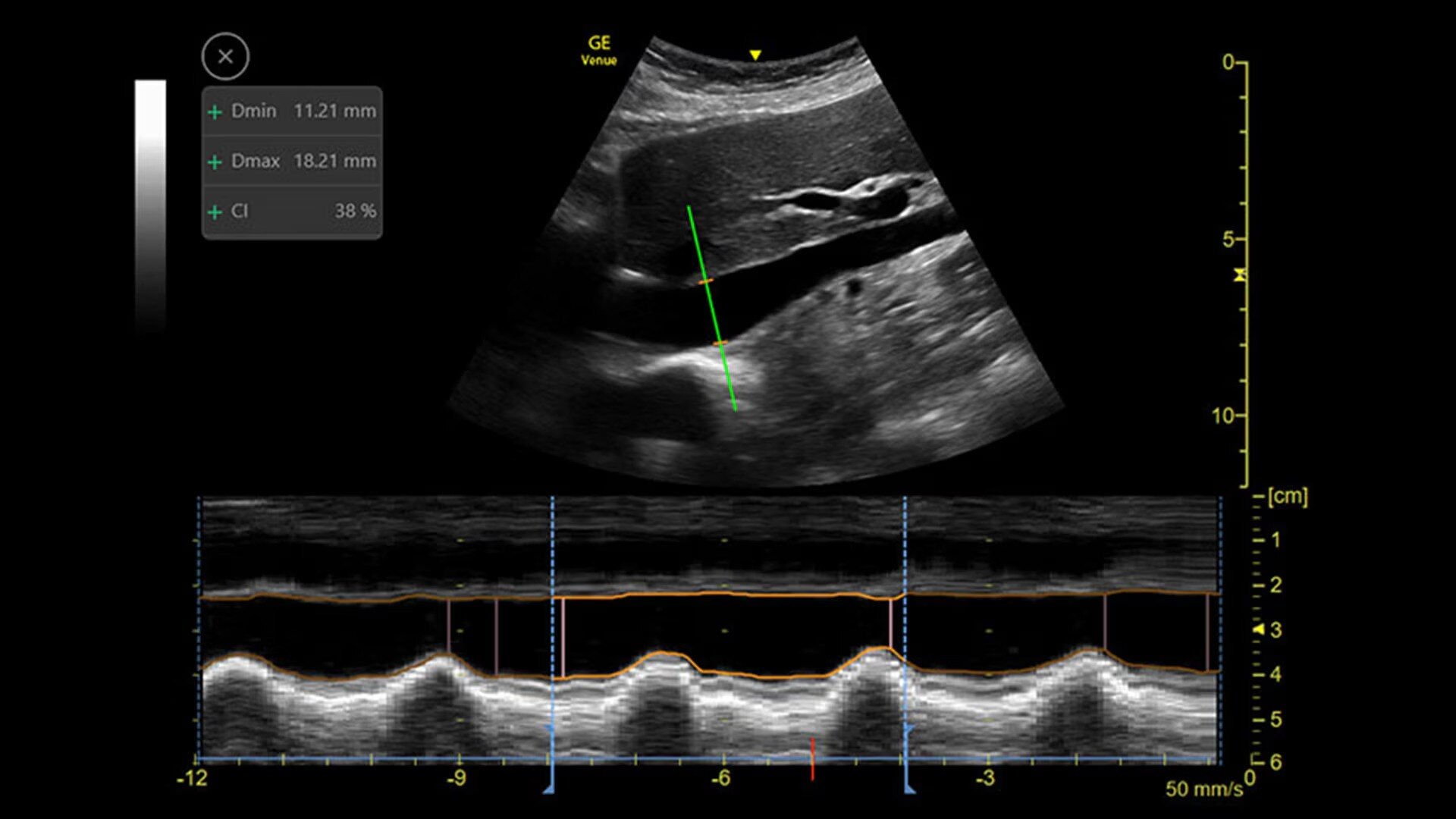 Product Media Carousel Image