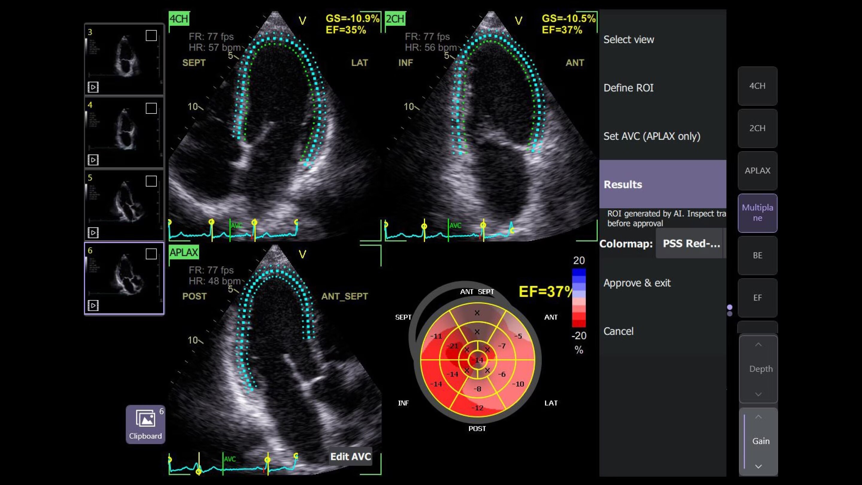 Product Media Carousel Image