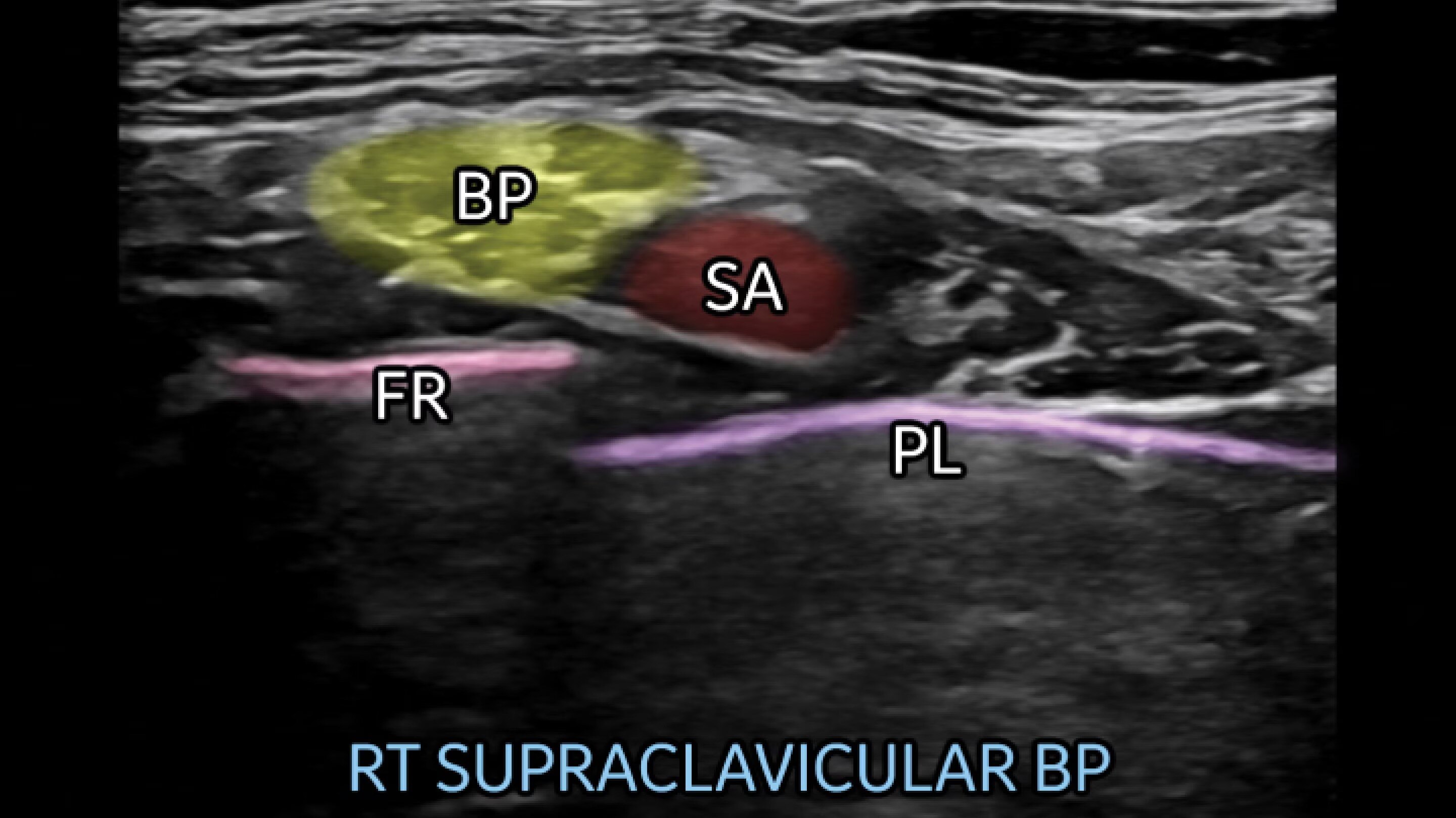 Product Media Carousel Image