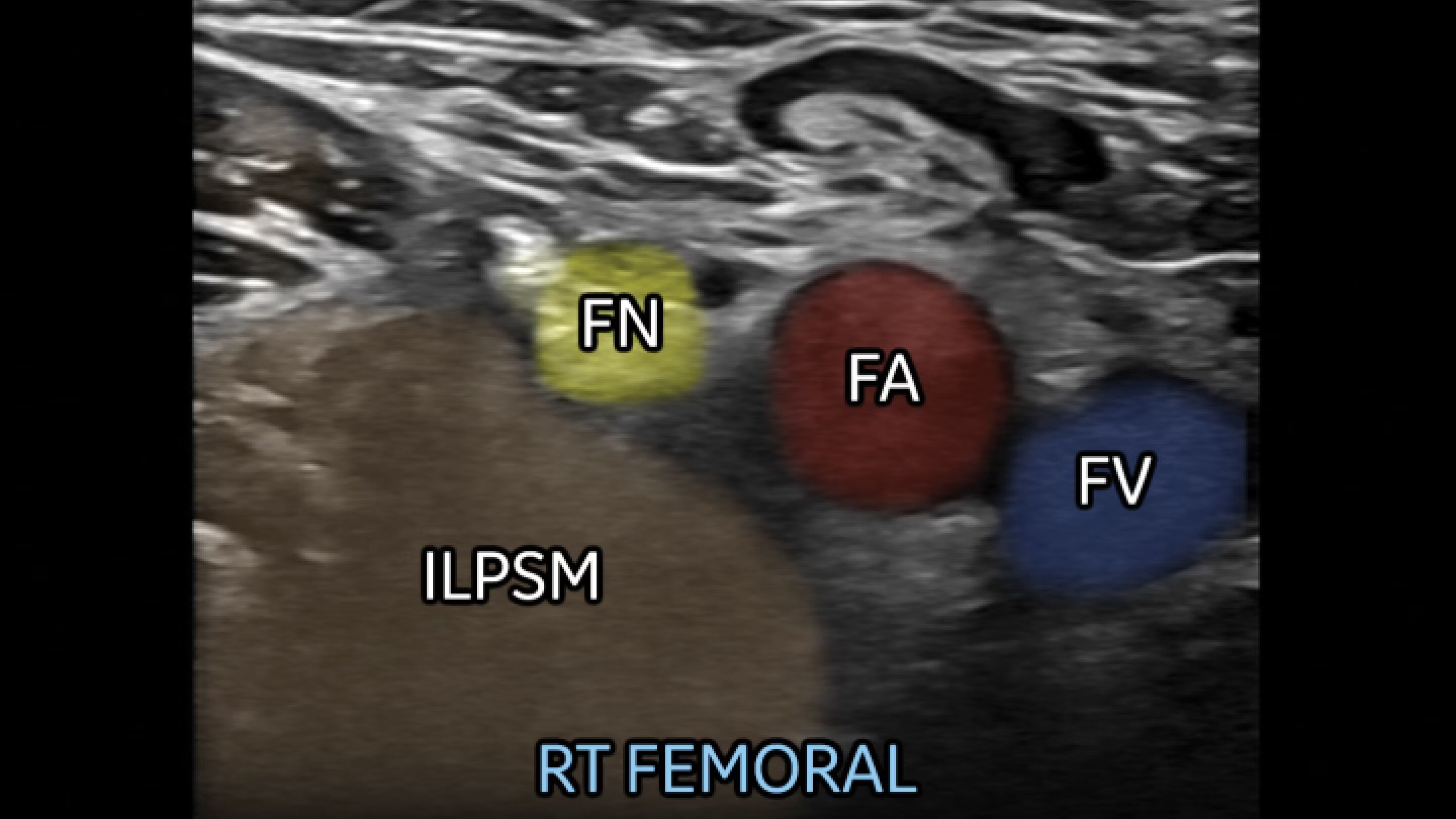 Product Media Carousel Image