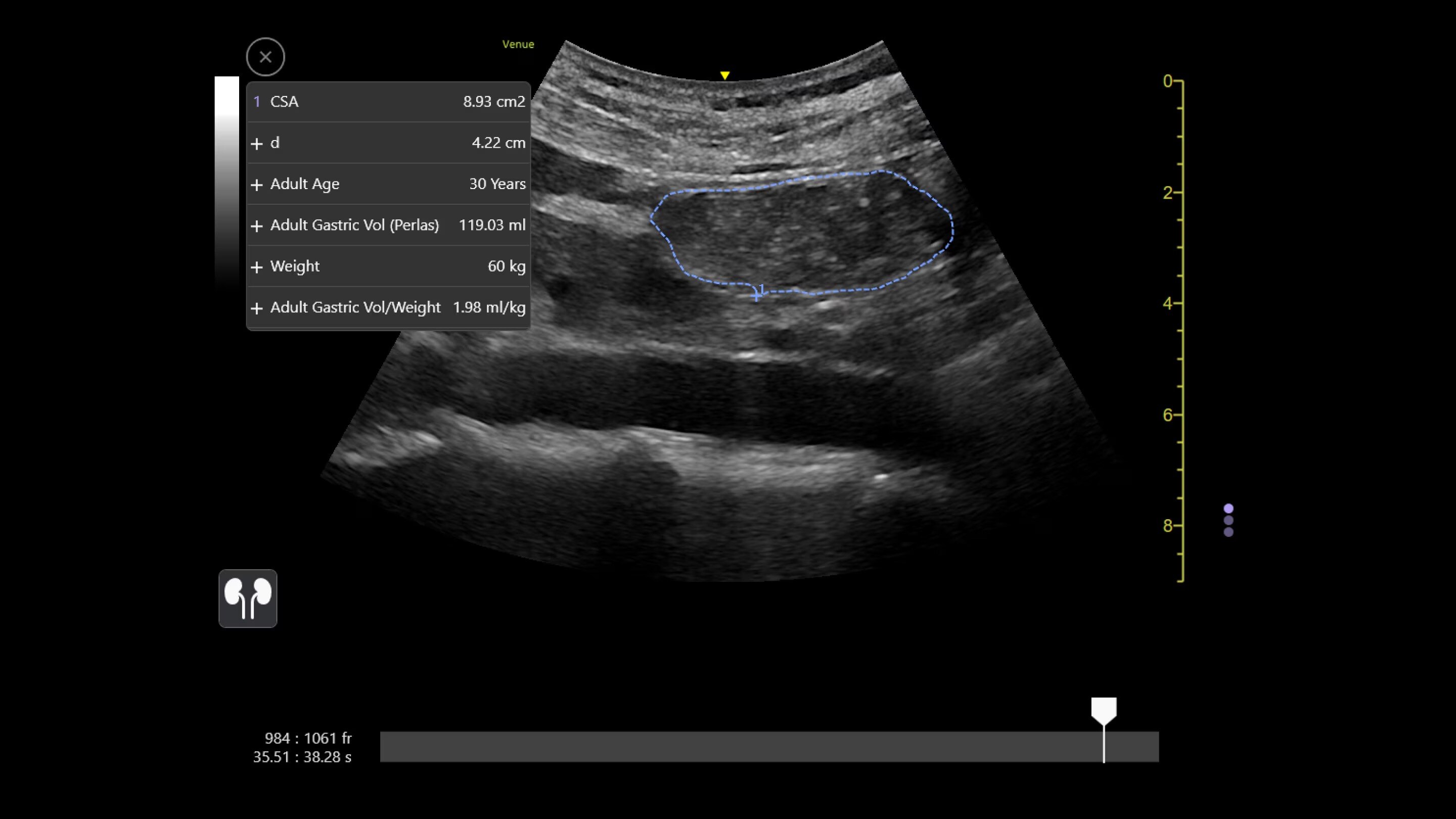 Product Media Carousel Image