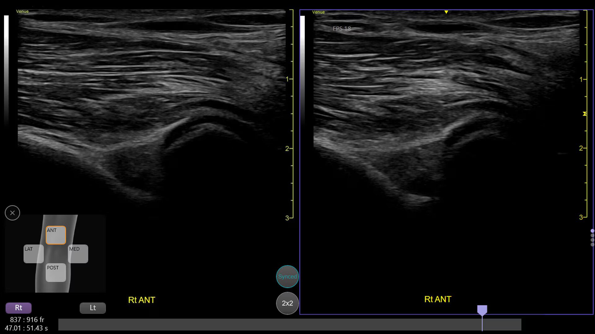 Product Media Carousel Image