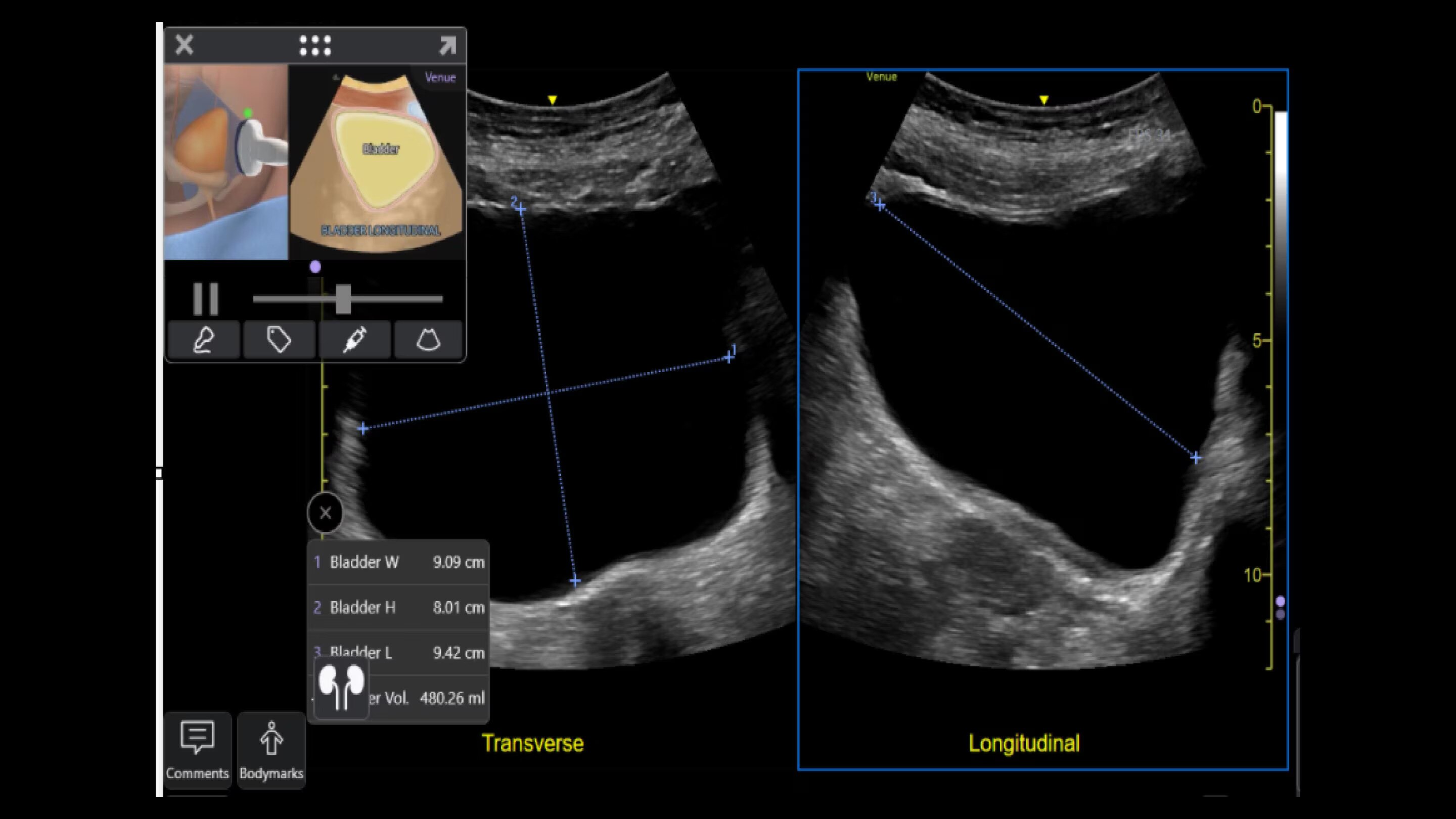 Product Media Carousel Image