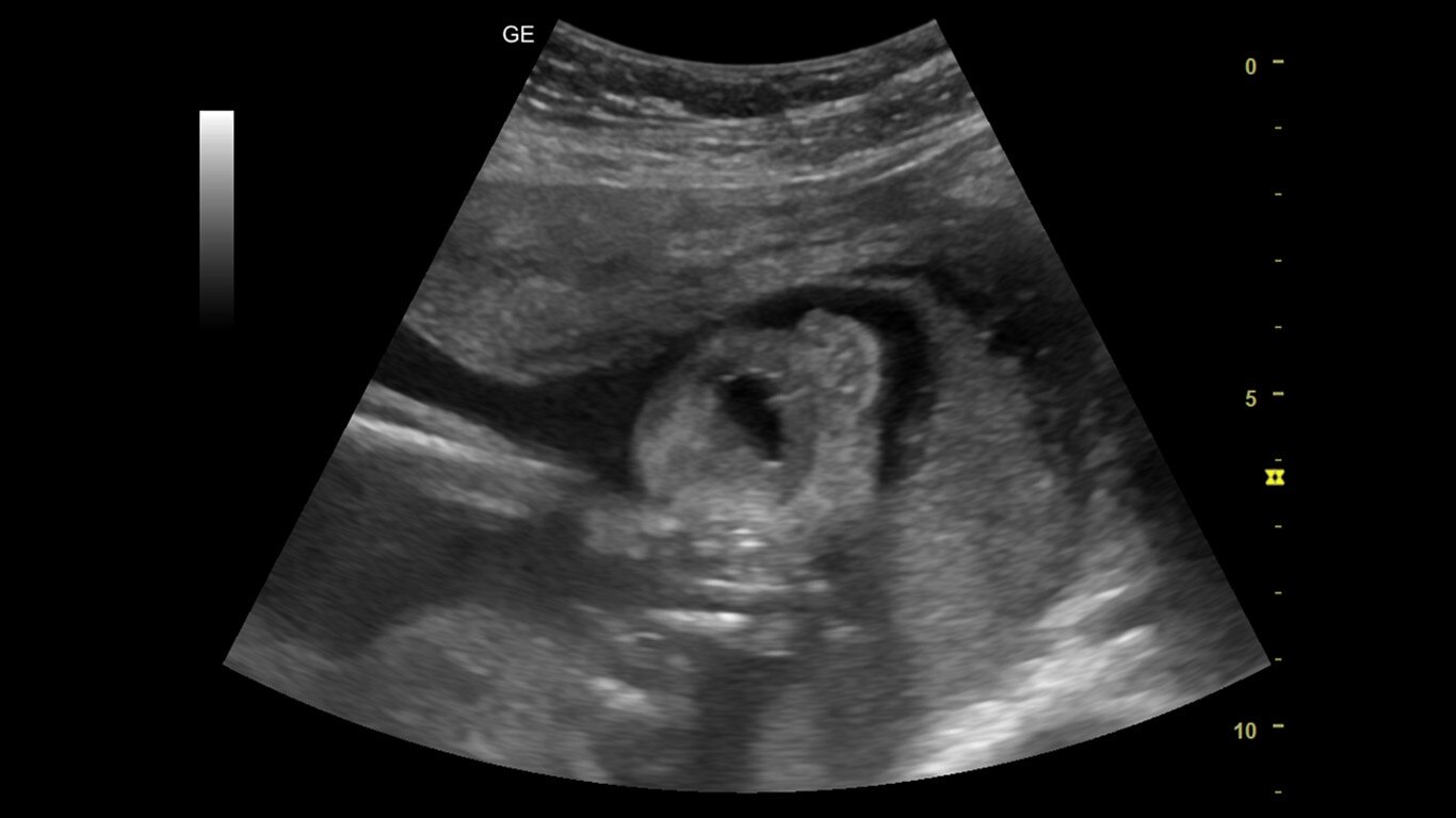 Product Media Carousel Image